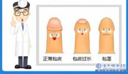 金华包皮过长会导致你不能性生活,你信吗