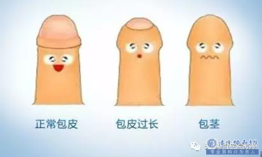 金华影响包皮手术费用有哪些？价格有点惊人
