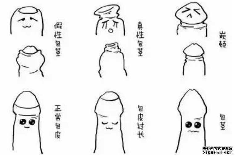 金华做包皮手术需要多少钱？不要小看“包皮过长”!