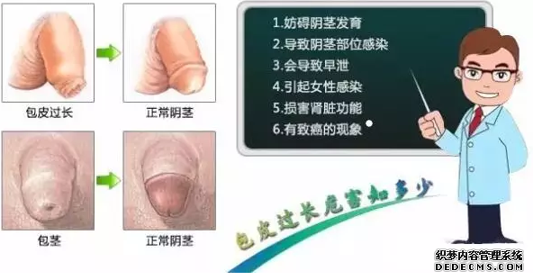 金华割包皮技术成熟了么，哪家性价比高？