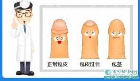 金华男科医院：包皮过长怎么办？不想做手术