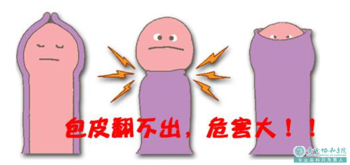 金华包皮到底要不要割?先搞懂这4个问题!