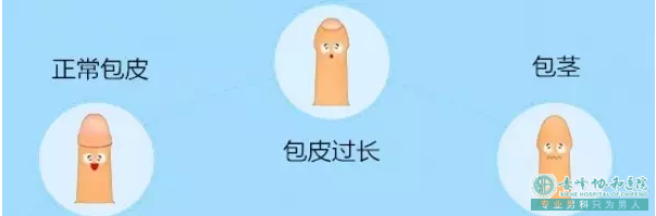 金华东阳市如何判断男性是不是包皮过长