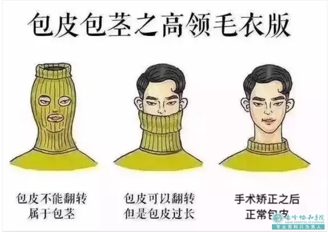 金华兰溪市包皮过长的治疗误区有哪些