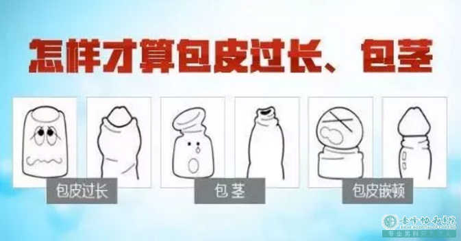 金华宁城县患上包皮包茎的临床表现有哪些